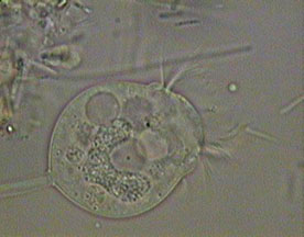 Member of Protista (Vorticella)